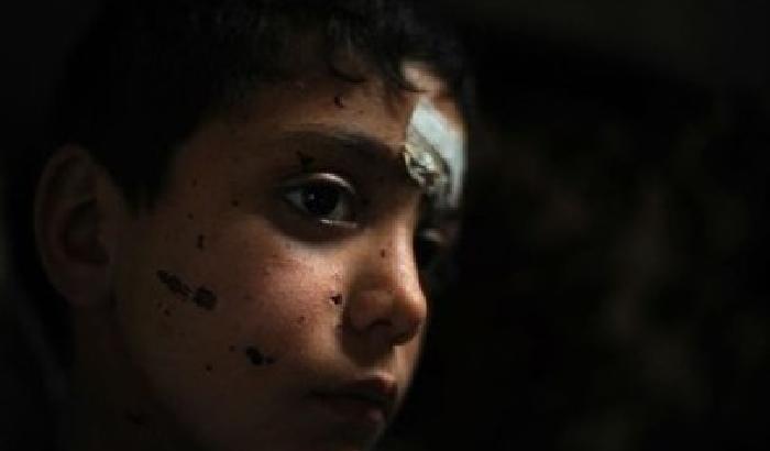 In Siria torture atroci sui bambini