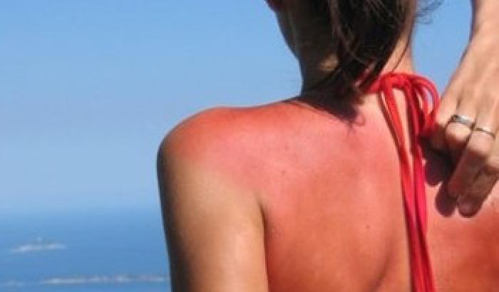 Come prevenire le scottature al mare