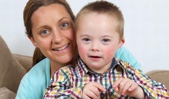 00CC34-NEWS_103286 La storia di Seb, il baby modello down che commuove il web