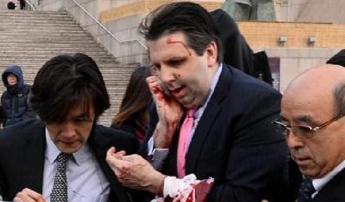 Corea del Sud: aggredito con un coltello l'ambasciatore Usa