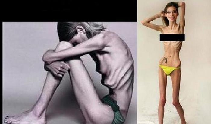 Arriva la legge anti-anoressia: le modelle troppo magre non sfilano