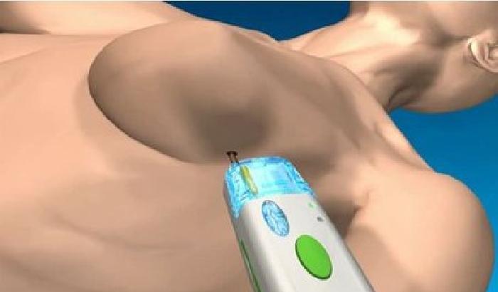 Un esame del sangue ci dirà se abbiamo un tumore