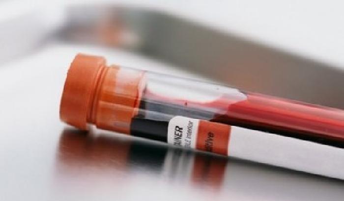 0119F5-NEWS_146192 Tumori: addio alle biopsie, basterà un prelievo di sangue