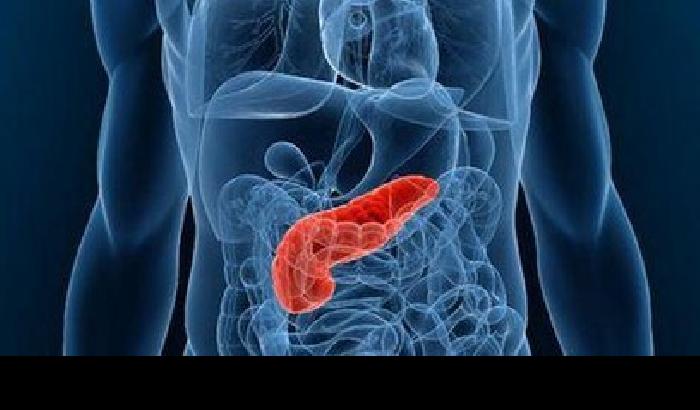 Cancro al pancreas? Si scopre con test delle urine
