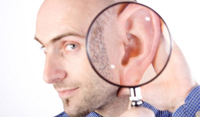 033FB1-orecchie-a-sventola Orecchie a sventola