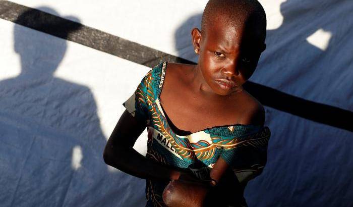 Una bambina mutilata nella repubblica democratica del Congo
