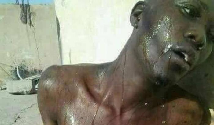 000531EA-un-uomo-torturato-in-libia Un uomo torturato in Libia