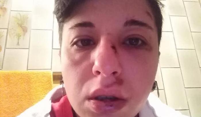 Giulia, setto nasale rotto perché lesbica: l'Italia si conferma un paese omofobo e ignorante
