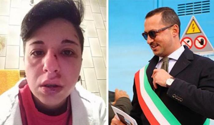 Aggressione omofoba a Potenza, il sindaco (leghista) condanna ma minimizza: "È un atto isolato"