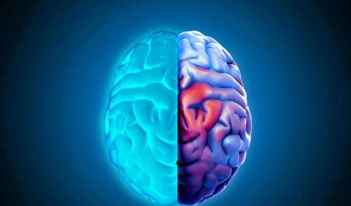 Metà cervello