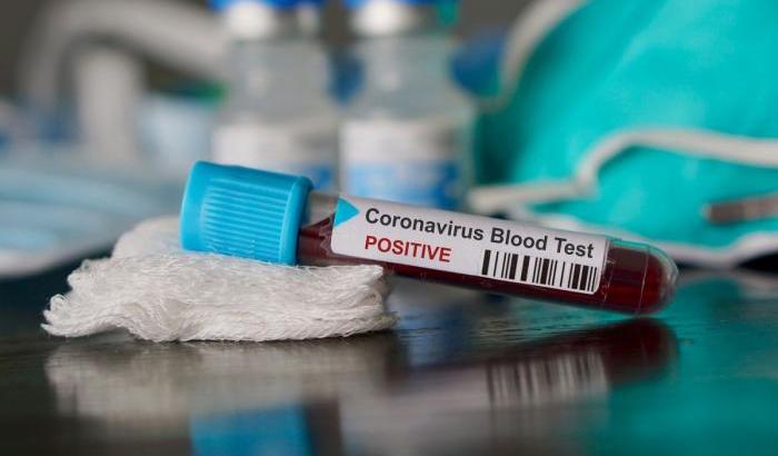 00055FFE-coronavirus Coronavirus