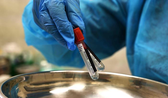 Coronavirus