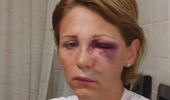 Donna brutalmente picchiata in un supermercato a Gallarate (Varese)