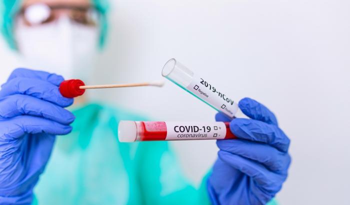 00057AE2-covid Tamponi Covid