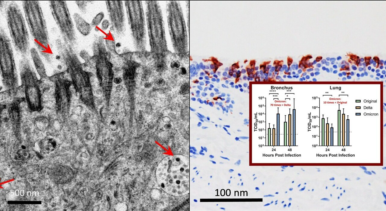 La variante Omicron si replica 70 volte più velocemente nei bronchi, ma meno nei polmoni: lo studio