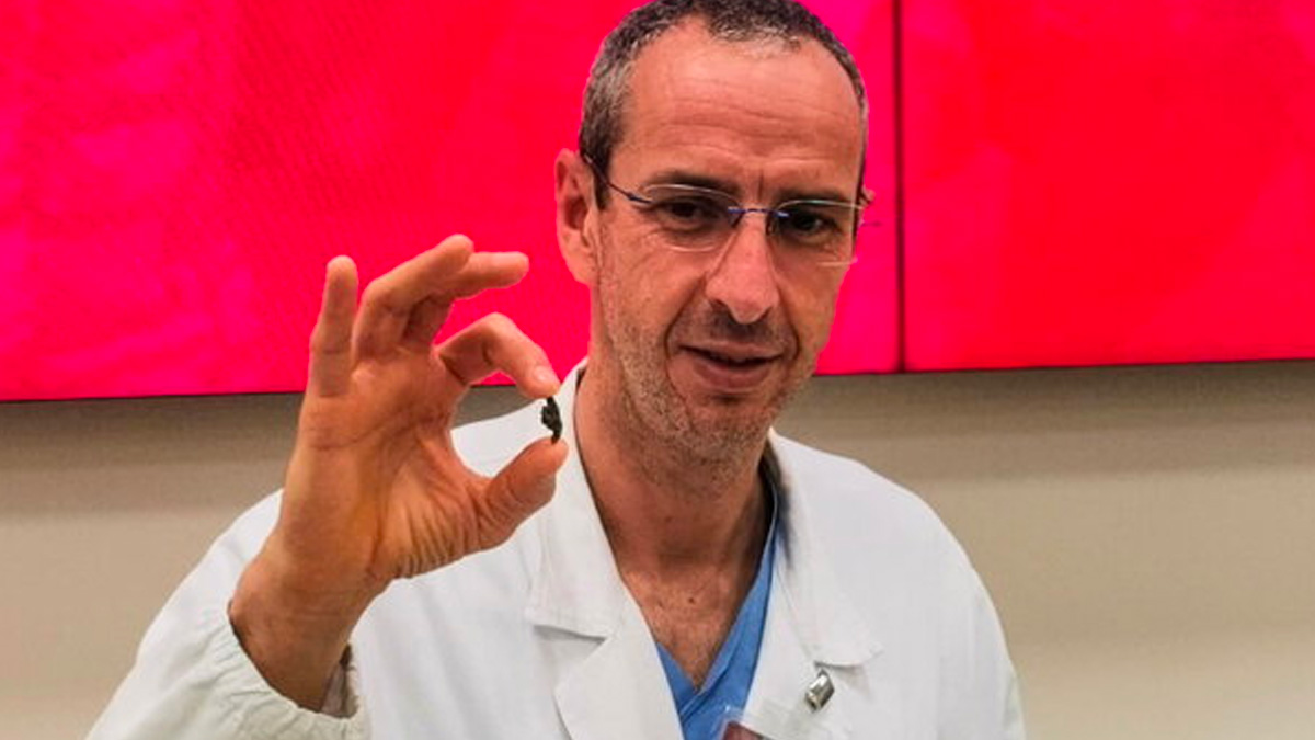 Bambino ucraino operato con una scheggia nel cuore, salvato a Padova