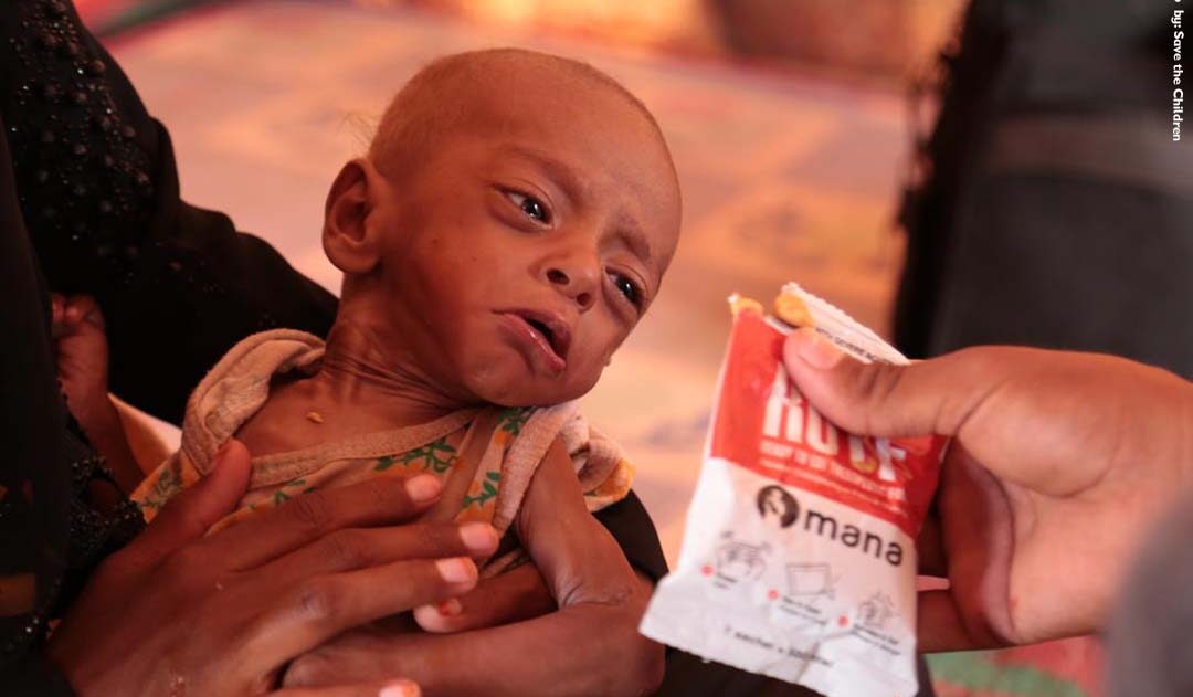 Yemen, la madre di tutte le guerre colpevolmente ignorate