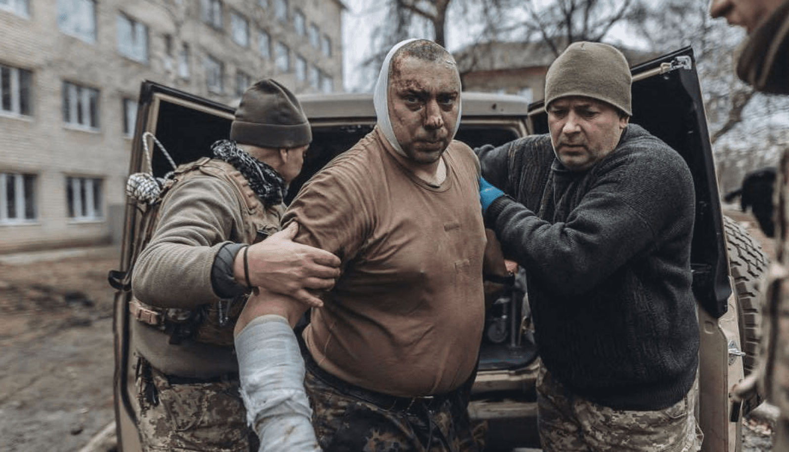 Un'ondata di soldati ucraini feriti arrivata negli ospedali dall'inizio della controffensiva Un'ondata di soldati ucraini feriti arrivata negli ospedali dall'inizio della controffensiva