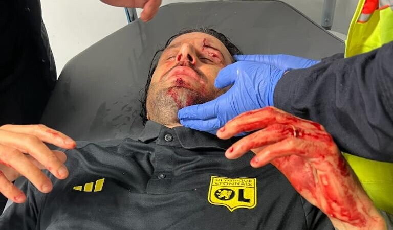 Sassate degli ultras del Marsiglia contro il pullman del Lione: ferito Fabio Grosso Sassate degli ultras del Marsiglia contro il pullman del Lione: ferito Fabio Grosso