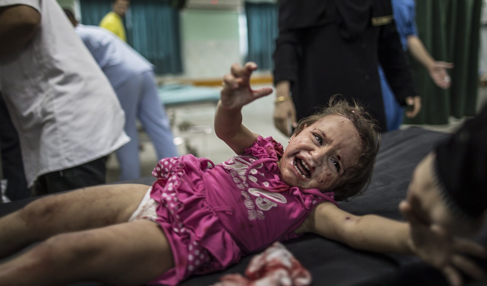 Gaza, fuori servizio il generatore del principale ospedale della Striscia