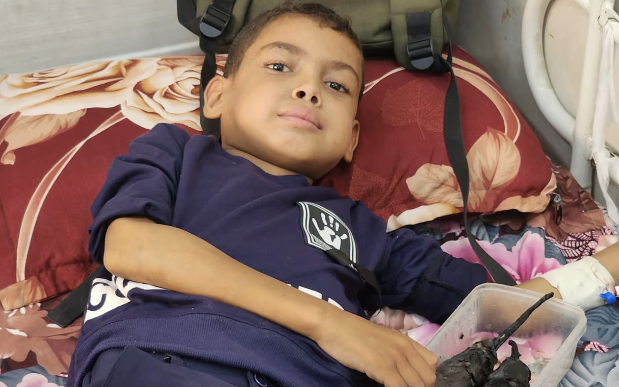 I bambini malati di Gaza in un limbo di tortura in attesa delle evacuazioni mediche: storia di Abdel Karim